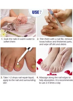 iBealee Nail Fungus treatment 7 Day Nail Repair Treatment Liquid for Damaged Toenails and Fingernails Fungal Nail Renewal Anti Fungus Nail Repair Smooth Moisturize Nail Reduce Discoloration Nail Serum 20ml  - Image 5