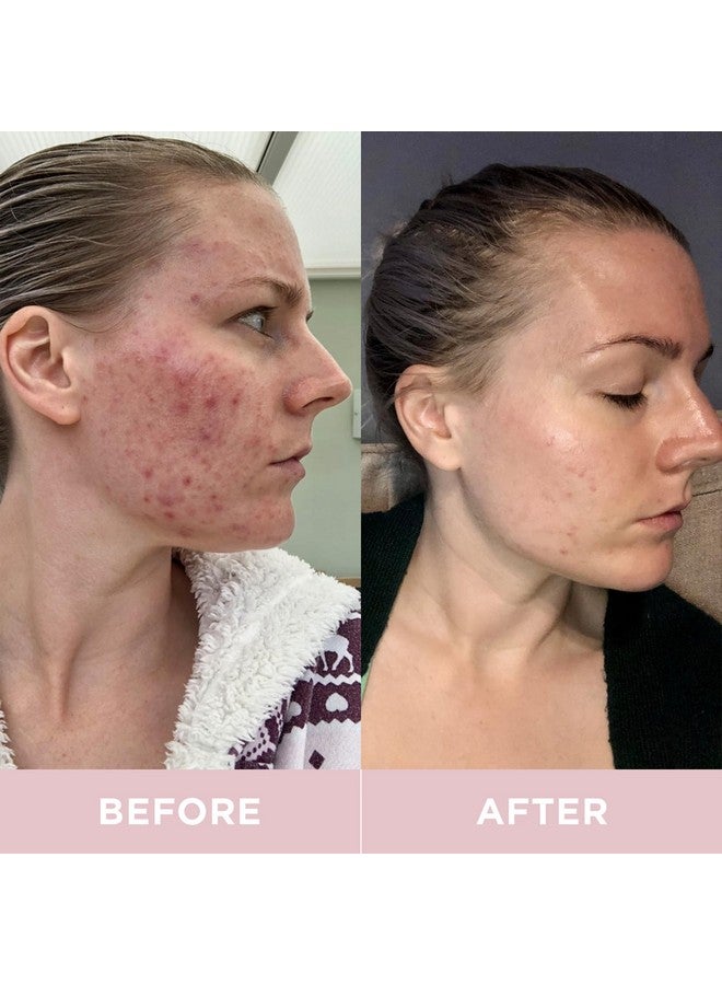 Revive Collagen مشروبات مكملات الكولاجين البحري المعالج 8,500 ملغ مع حمض الهيالورونيك والألوة فيرا لصحة البشرة والشعر والأظافر والمفاصل | ليمون وليمون أخضر (إمداد لمدة 14 يومًا) - Image 5