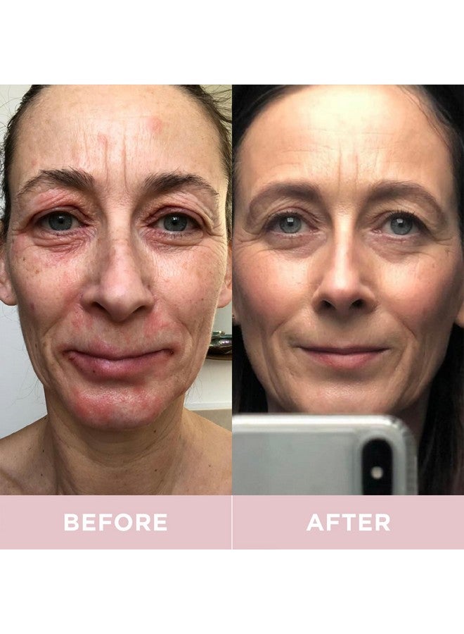 Revive Collagen مشروبات مكملات الكولاجين البحري المعالج 8,500 ملغ مع حمض الهيالورونيك والألوة فيرا لصحة البشرة والشعر والأظافر والمفاصل | ليمون وليمون أخضر (إمداد لمدة 14 يومًا) - Image 3