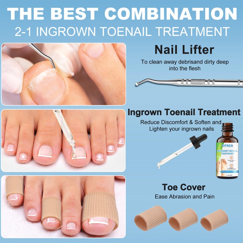 GIFBEA Ingrown Toenail Treatment w/Ingrown Toenail Drops Reliever & Softener,Double Sided Pedicure Nail Lifter Tool for Easy Trimming Care Thick Nail & Ingrown Toe Nail,Toenail Cleaner Kit for Men Women - Image 2