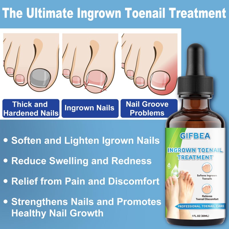 GIFBEA Ingrown Toenail Treatment w/Ingrown Toenail Drops Reliever & Softener,Double Sided Pedicure Nail Lifter Tool for Easy Trimming Care Thick Nail & Ingrown Toe Nail,Toenail Cleaner Kit for Men Women - Image 4