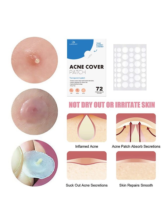 LANEMAY 36- Piece Acne Pimple Patch for Large Zit Breakouts, Spot Treatment Stickers for Body, Cheek, Forehead, and Chin, Vegan and Cruelty Free  - Image 4