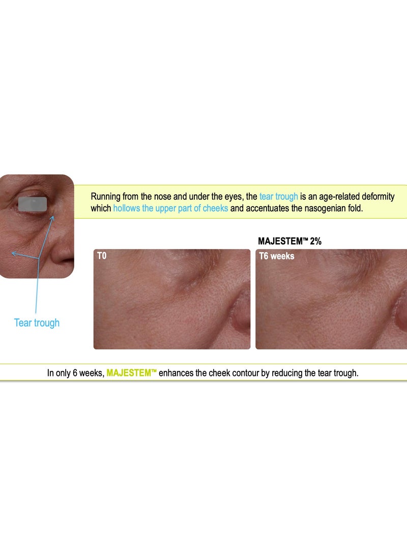 Neue Extra Repair Eye Cream - Image 4