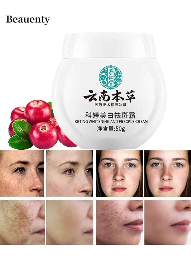 Beauenty White Spot Cream, Whitening Freckle Cream Remove Melasma Cream, Dark Spot Remover For Face Hyperpigmentation Treatment, Dark Spot Corrector For Face, Smooth Skin Moisturizer Cream 50G  - Image 1