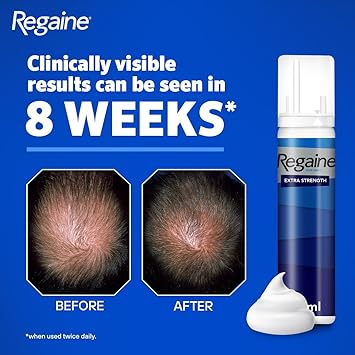 Regaine ريغين للرجال رغوة قوية إضافية مثبتة علمياً للمساعدة في إيقاف تساقط الشعر الوراثي رغوة مينوكسيديل لنمو الشعر 73 مل قد يختلف التعبئة والتغليف - Image 3