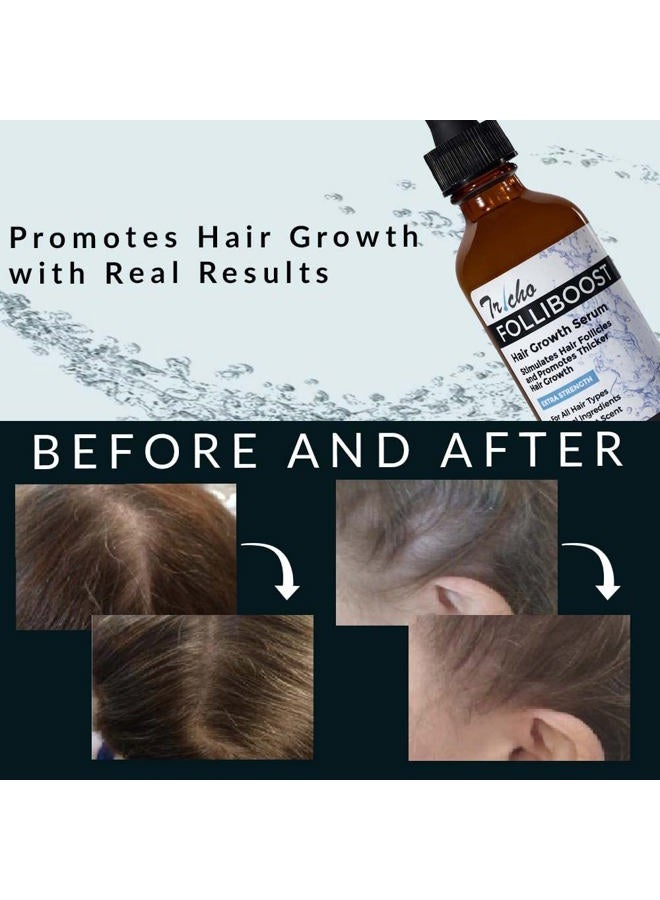 Folliboost Tricho Labs Folliboost Hair Growth Serum - Natural-Based Formula w/Biotin & Peppermint Oil - Hair Care for Thicker & Fuller Hair - 2oz, 6-Pack - Image 4