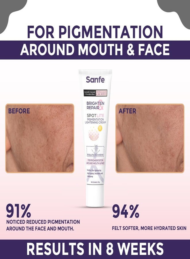 Sanfe Dark Spot Remover for Face| Dark Spot Corrector Glow cream| Skin Brown Spot Remover Age Spot Corrector| Rapid Tone Repair Retinol| Skin Care Face Body Cream For Face, Armpits Hands Knees & Body - Image 1