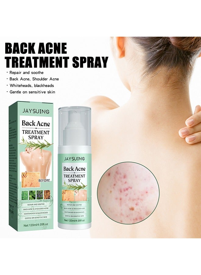 جايسوينغ بخاخ علاج حب الشباب الخلفي ، تفتيح علامات حب الشباب إصلاح الكتف الخلفي حب الشباب الجلد ، 2 ٪ حمض الساليسيليك وزيت شجرة الشاي بخاخ 120ML - Image 1