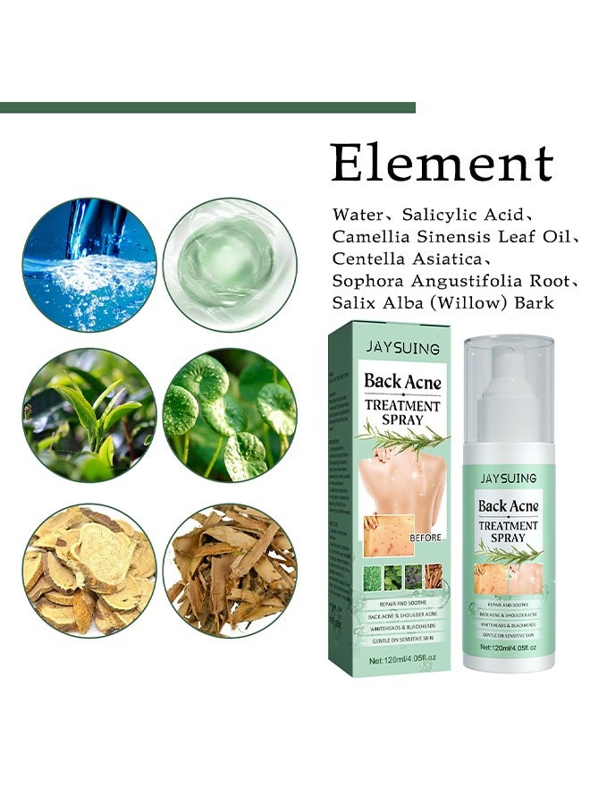 جايسوينغ بخاخ علاج حب الشباب الخلفي ، تفتيح علامات حب الشباب إصلاح الكتف الخلفي حب الشباب الجلد ، 2 ٪ حمض الساليسيليك وزيت شجرة الشاي بخاخ 120ML - Image 5