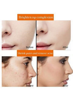 Quat Vitamin C With Vitamin E Face Serum For Face Whitening & Brightening 30Ml  - Image 2