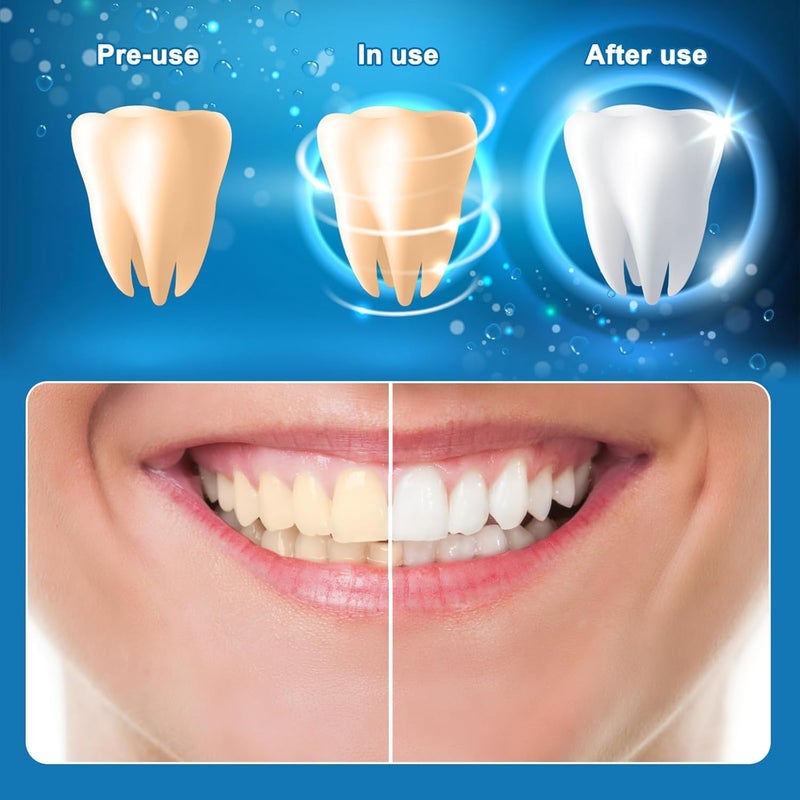 VPGS Teeth Whitening Strips, Professional Effects White Strips for Teeth Whitening, Reduce Sensitivity and Remove Coffee and Tea Stains, 7 Whitening Treatments - (14 Strips) - Image 4