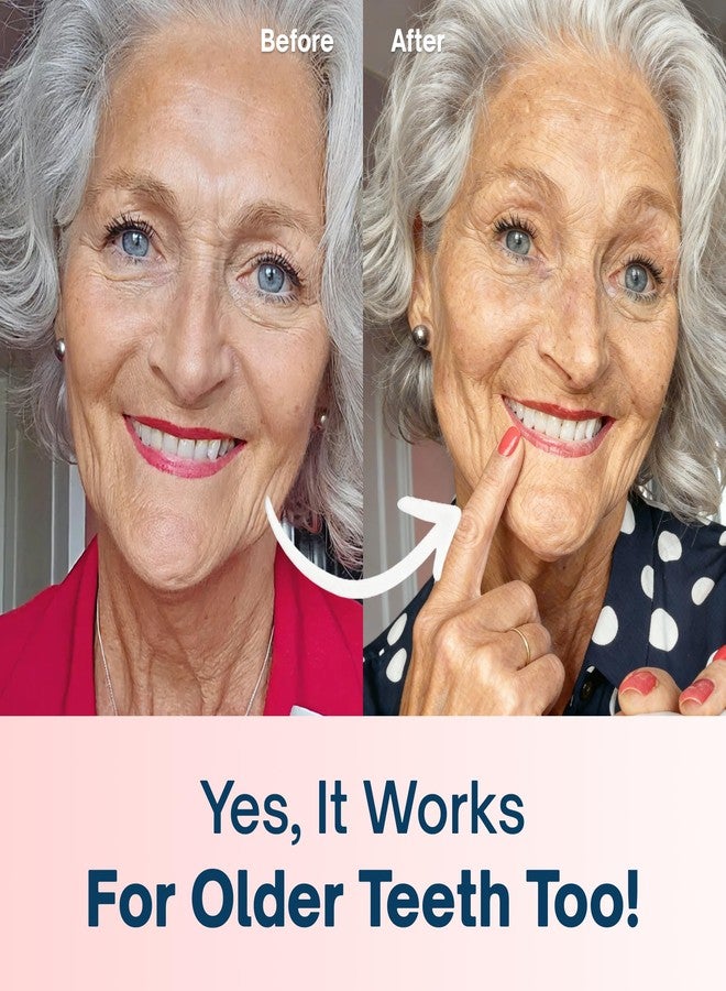 MySweetSmile Strawberry Teeth Whitening Powder – 6 Month Supply – Removes Years of Coffee, Tea, Smoking & Ageing Stains – Dentist-Approved & Enamel-Safe – IndyBest Award-Winning Whitener - Image 5