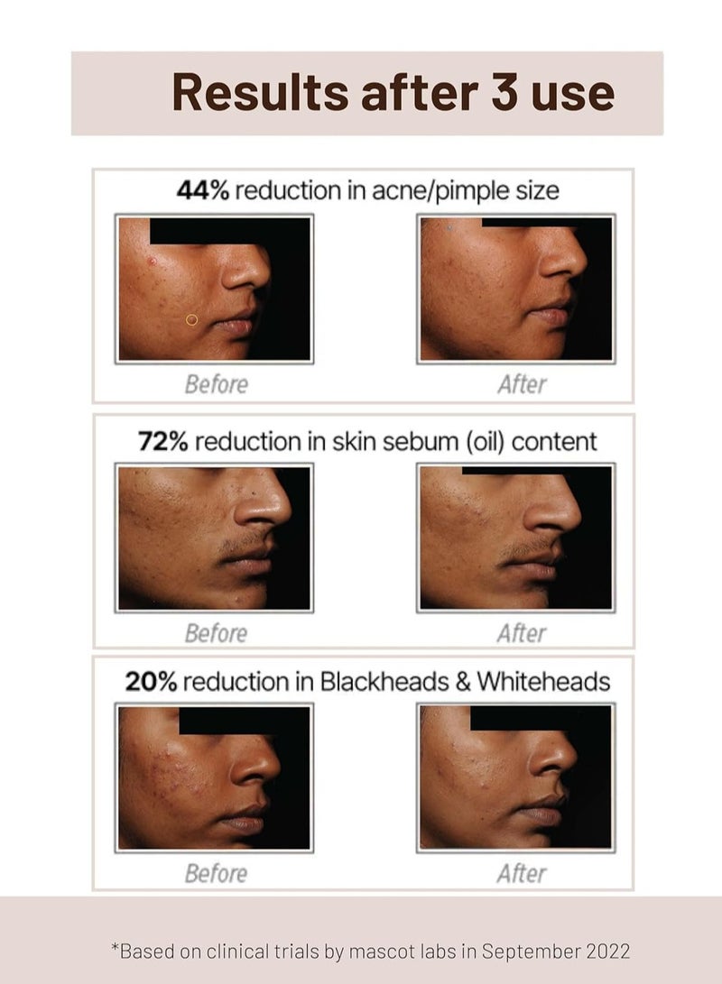 SkinQ Acne Control Face Mask with Salicylic Acid Niacinamide and Zinc BHA Based Reduces Clogged Pores Controls Oiliness for All Skin Types Women and Men 60g - Image 3