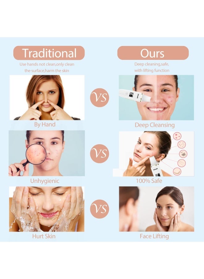 جهاز تقشير البشرة – مزيل الرؤوس السوداء، منظف المسام، مكشطة للعناية بالبشرة وتقشير الوجه - Image 4
