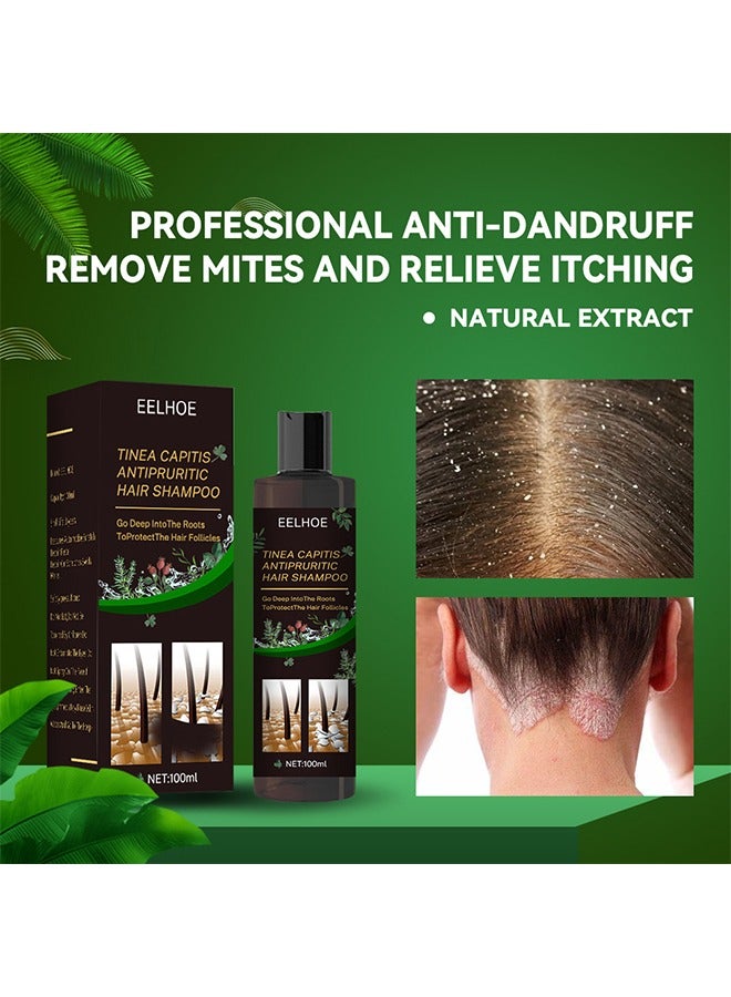 EELHOE Tinea Capitis Antipruritic Hair Shampoo- Deep Clean Safe Gentle Effective Professional Anti-Dandruff Remove Mites and Relieve Itching Natural Extract Anti Hair Loss 100ml - Image 2