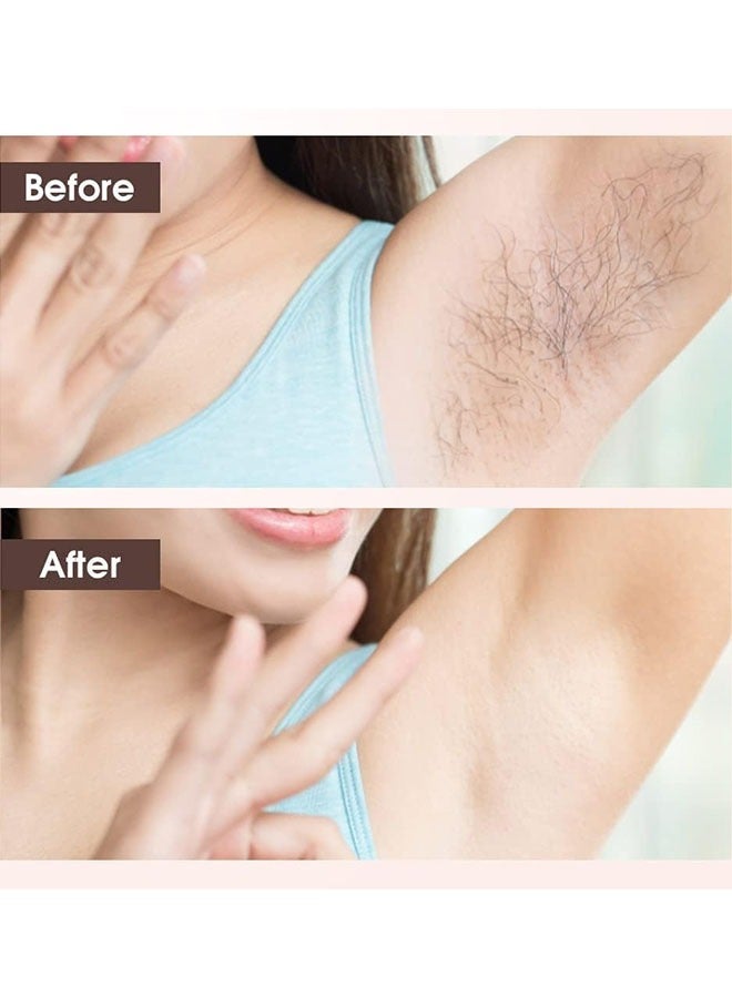 general Hair Removal Epilator, Electric Razor for Women, USB Charging Compact Hair Removal Tool for Arms, Legs, Underarms, Bikini Area, and Face (Pink) - Image 3