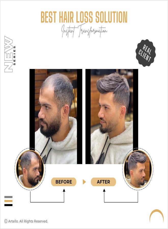 Artello® REGULAR MONO Hair Patch for Men, 100% Indian Human Hair Wig with FREE Yellow Adhesive Tape, Red Protection Tape and set of 4 Clips, Easy to Fix and Self Service (Colour: Darkest Brown) (8x6) - Image 3