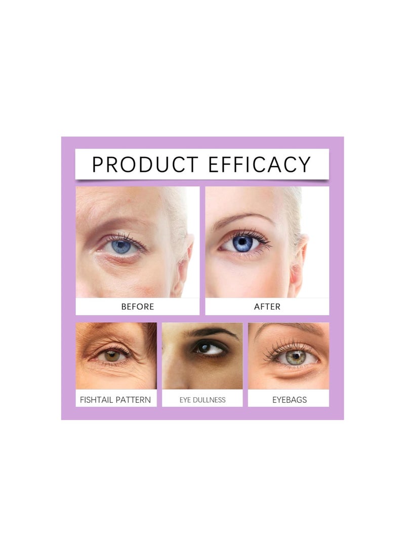 Generic - Eye Puffiness Remover Cream,20g Eye Repair Cream,Puffy Eyes Care,Instant Temporary Eye Tightener Cream,Reduces The Look Of Under Eye Bags (2PC) - Image 1