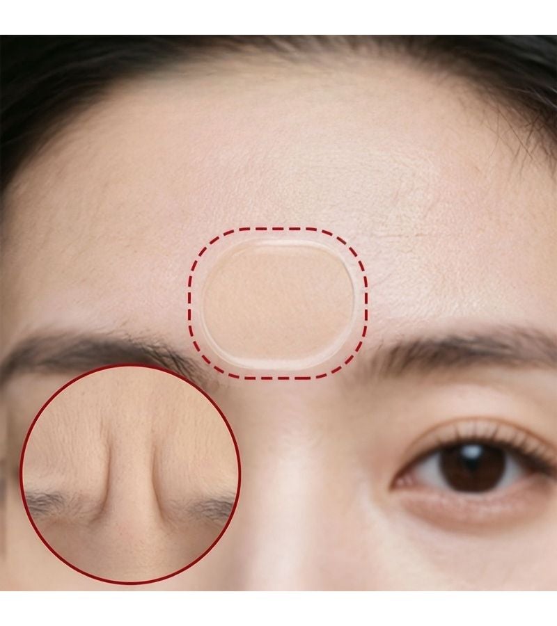 10pcs Silicone Self-Adhesive Sleeping Forehead Patch - Reusable Facial Elastic Patch for Forehead Full Face - Washable Sticky Reusable - Compact Portable for Daily Use Travel - Unisex - Image 2