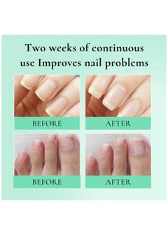 AuQuest Nail Cuticle Oil Care with Smooth & Soft Cuticles Brush for Nail Repair Care Treatment Cuticle Oil Pen Nails Moisturizer Manicure Nourish Oil Support Healthy Nail Growth  - Image 3