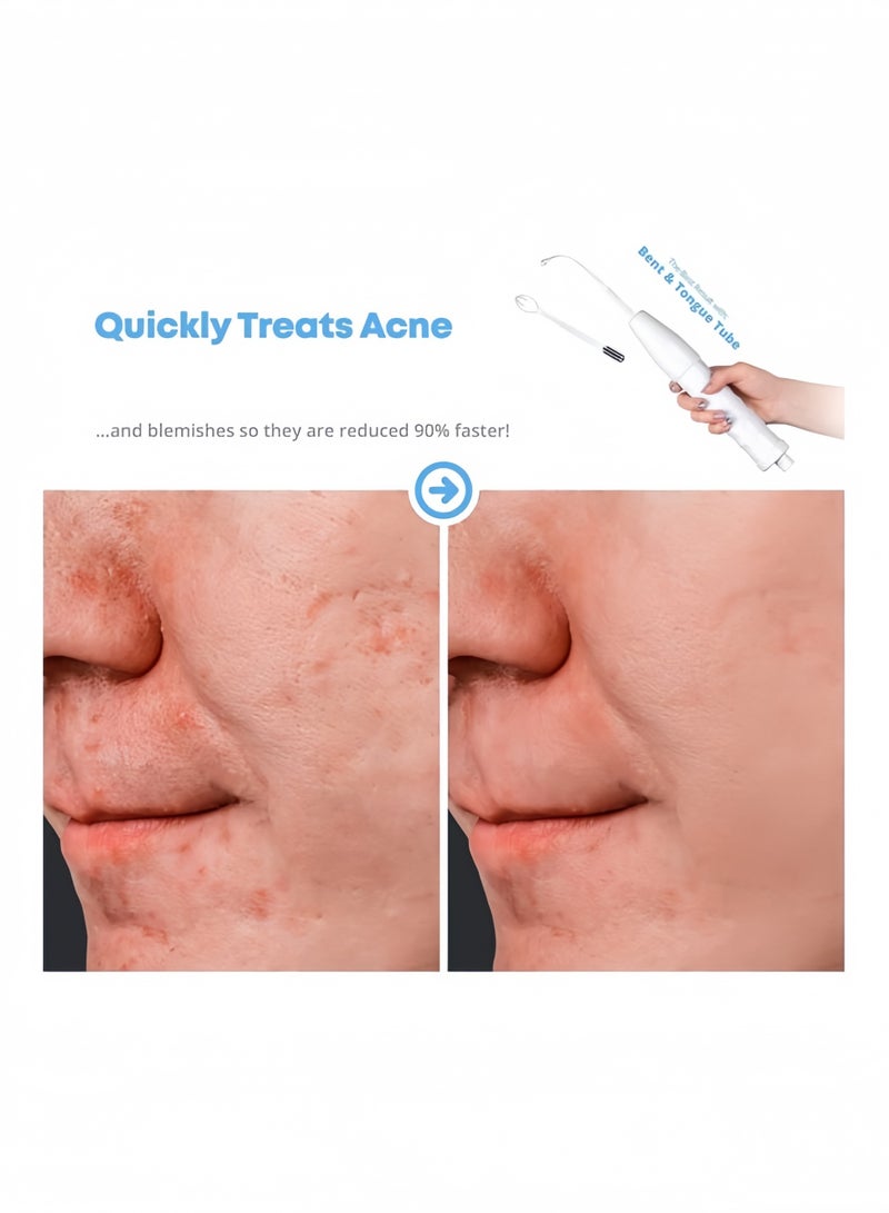 عصا الوجه عالية التردد - أداة محمولة لعلاج البشرة مع أقطاب نيون وأرجون - تساعد على دعم مظهر البشرة وفروة الرأس بشكل أكثر نقاء للوجه والشعر والعناية بمظهر حب الشباب المؤقت - Image 4