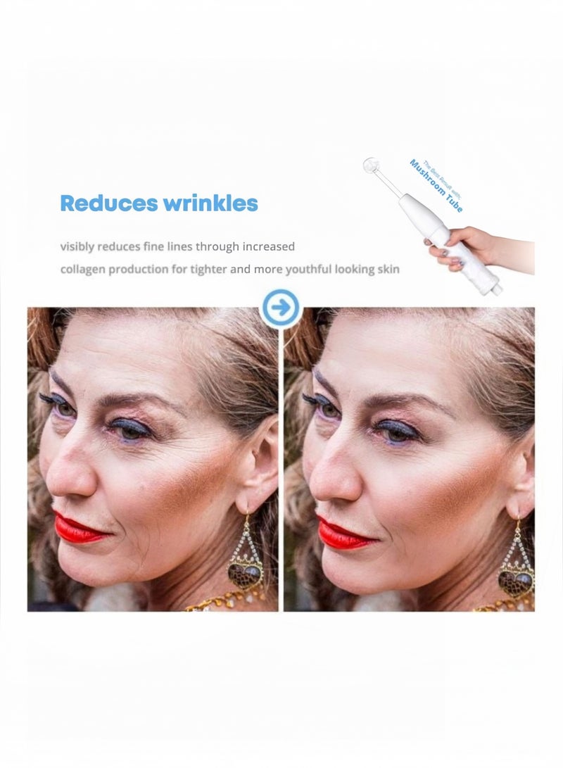 عصا الوجه عالية التردد - أداة محمولة لعلاج البشرة مع أقطاب نيون وأرجون - تساعد على دعم مظهر البشرة وفروة الرأس بشكل أكثر نقاء للوجه والشعر والعناية بمظهر حب الشباب المؤقت - Image 3