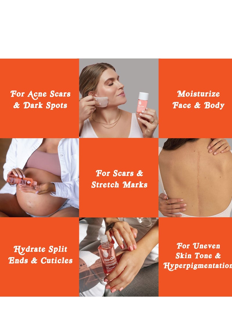 Bio-Oil Specialist Skincare Oil 200ml - Image 5