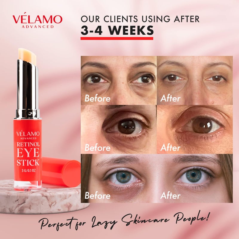 VELAMO ADVANCED Retinol Eye Balm Stick with Bakuchiol: Under Eye Cream for Dark Circles and Puffiness - Anti Aging Reduces Fine Lines Wrinkles Under Eye Bags in 4-8 Weeks 0.1 OZ/3g - Image 5