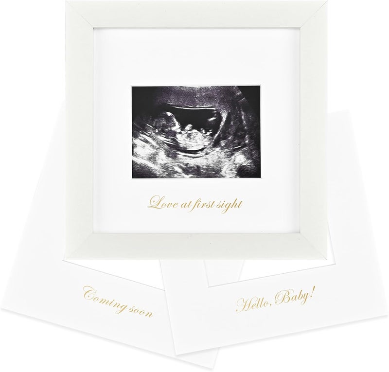 KINLINK Baby Sonogram Picture Frame Love at First Sight Ultrasound Picture Frame Pregnancy Gifts for Expecting MomDad Gender Reveal Party Baby Keepsake Announcement White - Image 1