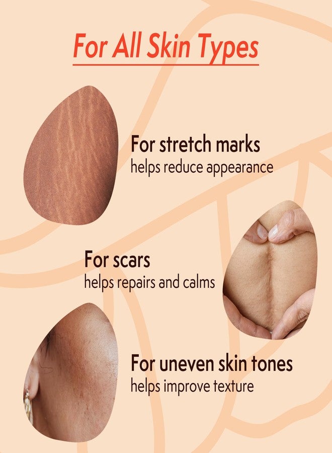 Nature Spell زيت علامات التمدد من ناتشر سبيل للنساء، زيت جسم نباتي لعلامات التمدد، الندوب وتفاوت لون البشرة، 3.38 أونصة سائلة - Image 2