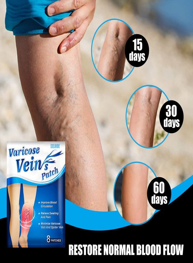 Haibing EELHOE 8Pcs Varicose Veins Patches Dredge Vein Smoothing Varicose Veins Reduce Swelling Relieve Pain - Image 4