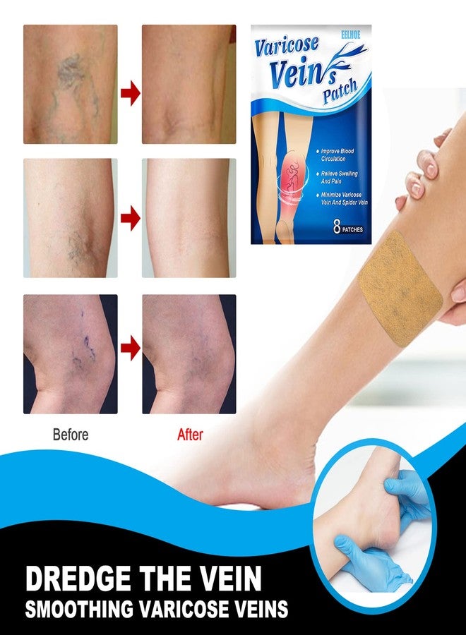 Haibing EELHOE 8Pcs Varicose Veins Patches Dredge Vein Smoothing Varicose Veins Reduce Swelling Relieve Pain - Image 3
