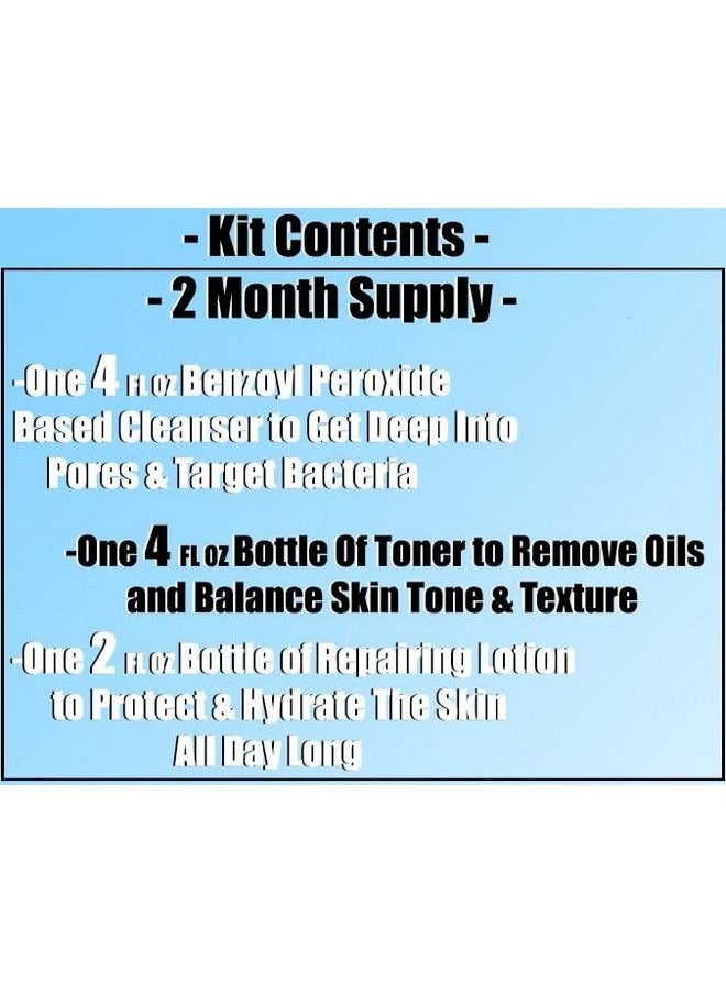 Walgreens - Complete Acne Treatment Kit 3 Simple Step Acne Kit Benzoyl Peroxide Based Cleanser Refreshing Toner & Spot Treatment Repairing Lotion 1.0 Fl Oz - Image 1