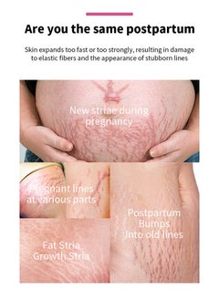 MOOYAM Stretch Mark Oil, Tummy Oil - Nutrient Enriched Body Oil for Growth Areas, Scars and Stretch Marks - Maternity, Prenatal and Antenatal - 1 Fluid Ounce/30ml  - Image 2