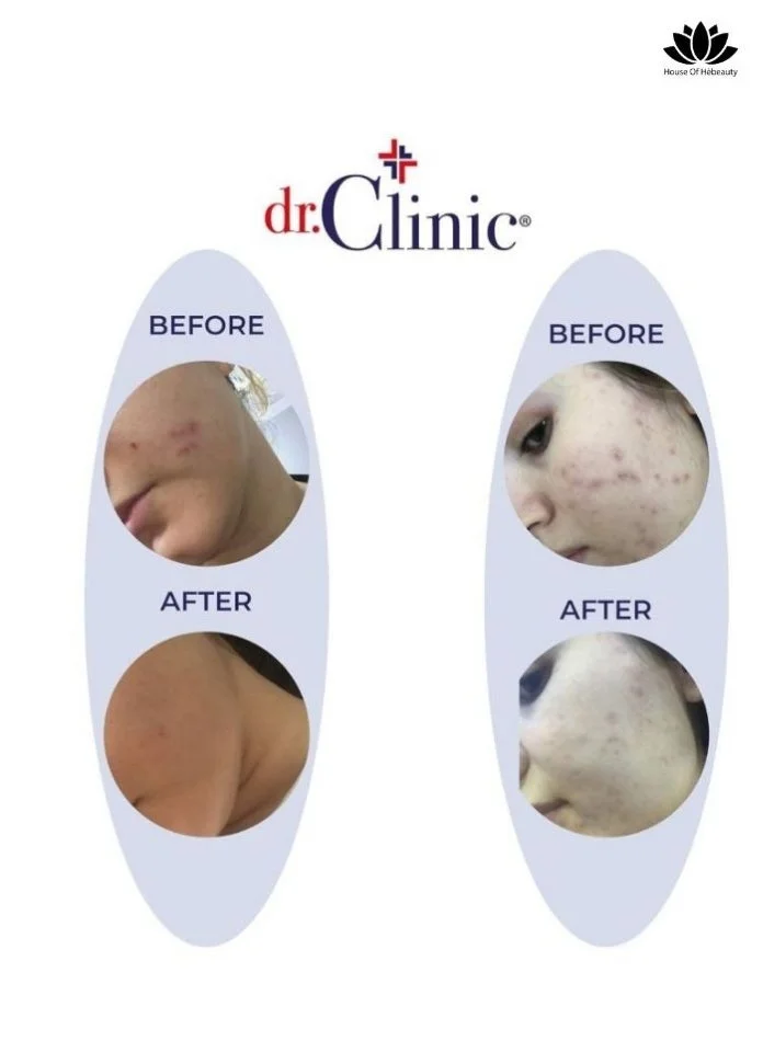 dr.Clinic DR. CLINIC | Prebiotic Cream with Collagen for All Skin Types | Extra Repair Facial Cream | Anti-Aging, Youthful Skin Revitalizing Treatment | Firming, Smoothing Wrinkles & Lines | 100 ml