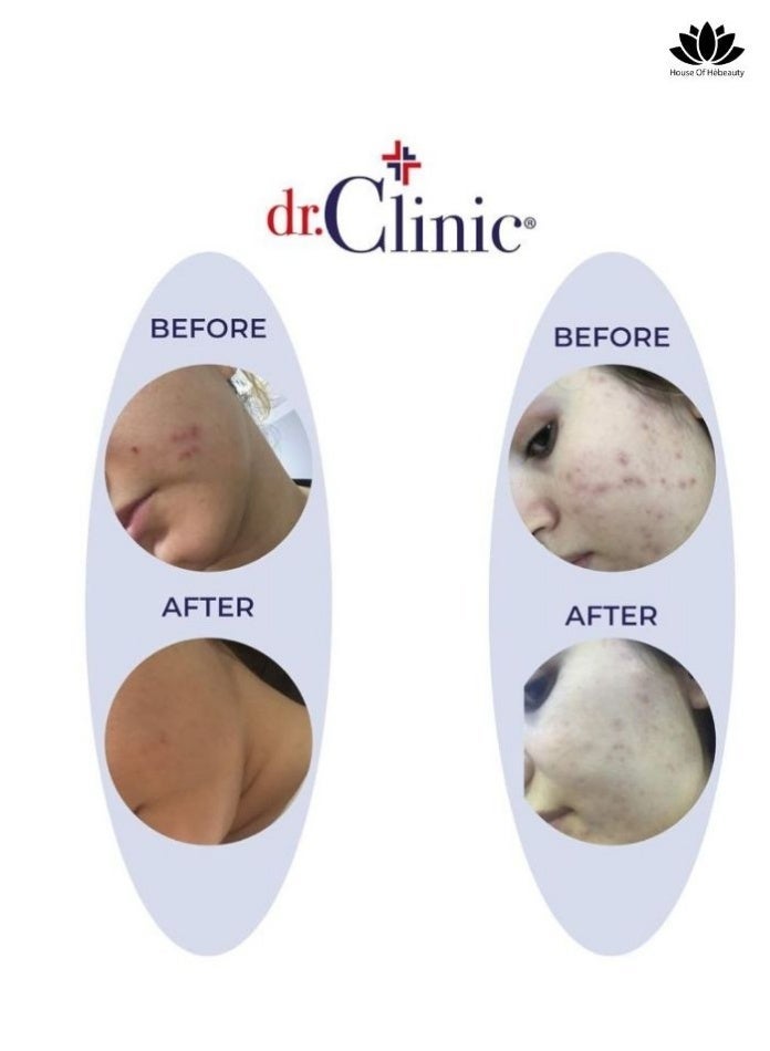 dr.Clinic DR. CLINIC | Prebiotic Cream with Collagen for All Skin Types | Extra Repair Facial Cream | Anti-Aging, Youthful Skin Revitalizing Treatment | Firming, Smoothing Wrinkles & Lines | 100 ml - Image 5
