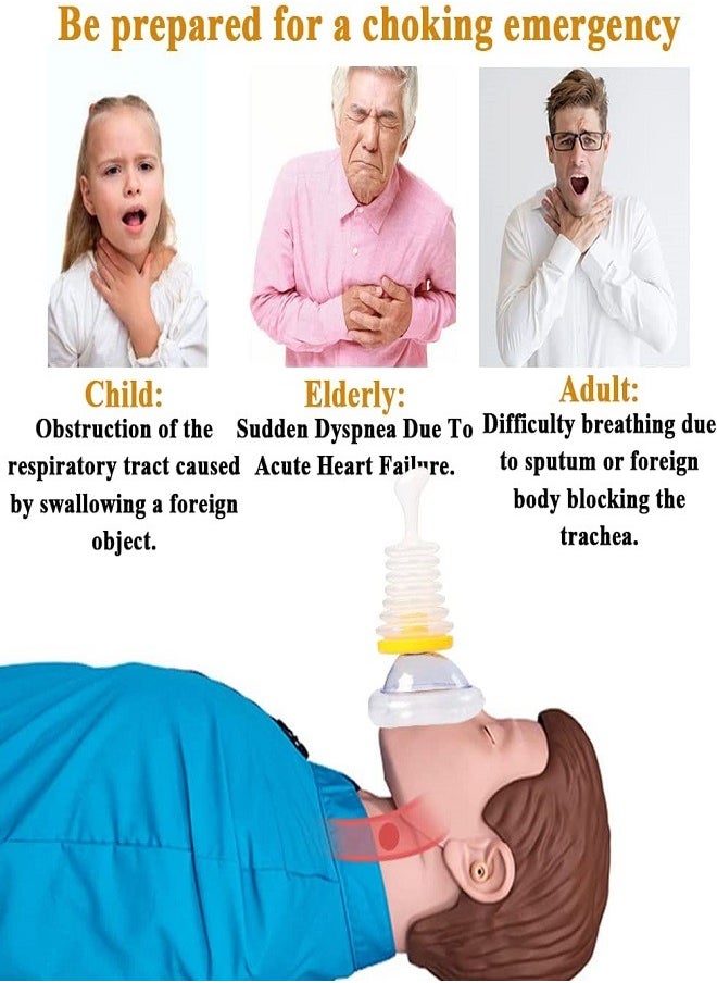 Generic - Anti Choking Rescue Device Home Kit for for Kids and Adults - Image 1