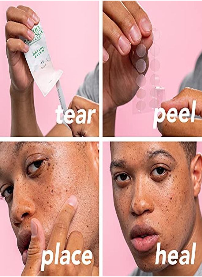 Drying Patch Blemish Covering, Invisible Spot Treatment, Absorbing All Day Polymer Adhesion With Vitamin C, Vegan & Cruelty Free, Strong Hold (60 Patches, 12Mm), Clear