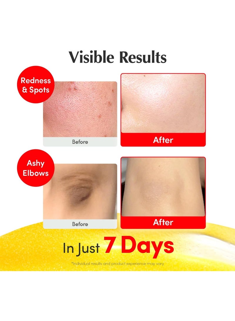 ك أو إي سي سيروم فيتامين سي المُضيئ - سيروم مُشرق بفيتامين سي مع النياسيناميد | يُقوي حاجز البشرة | يُرطب البشرة باستخدام السيراميد وحمض الهيالورونيك، 30 مل/1.01 أونصة - Image 3