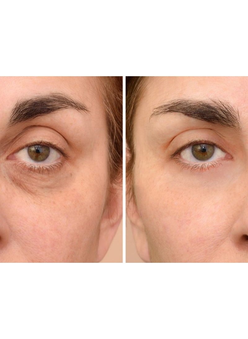 مستحضرات أيزل كريم ريتينول وفيتامين سي تحت العين للهالات السوداء للنساء والرجال | كريم لإزالة الهالات السوداء | كريم للهالات السوداء حول العين | كريم للهالات السوداء والتجاعيد والانتفاخات حول العين | 30 غرام - Image 4