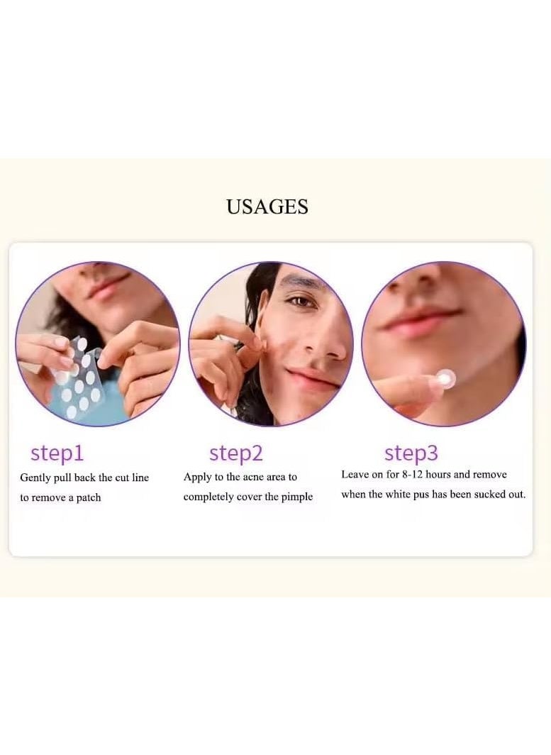 Bittern Acne Pimple Patches For Face 36 Pcs Invisible Facial Stickers cover with 100 Hydrocolloid Dressing Cover Dots for Spots Pimple Patches Effectively Calms Relieves Acne Facial Care Complete Pimple Remover