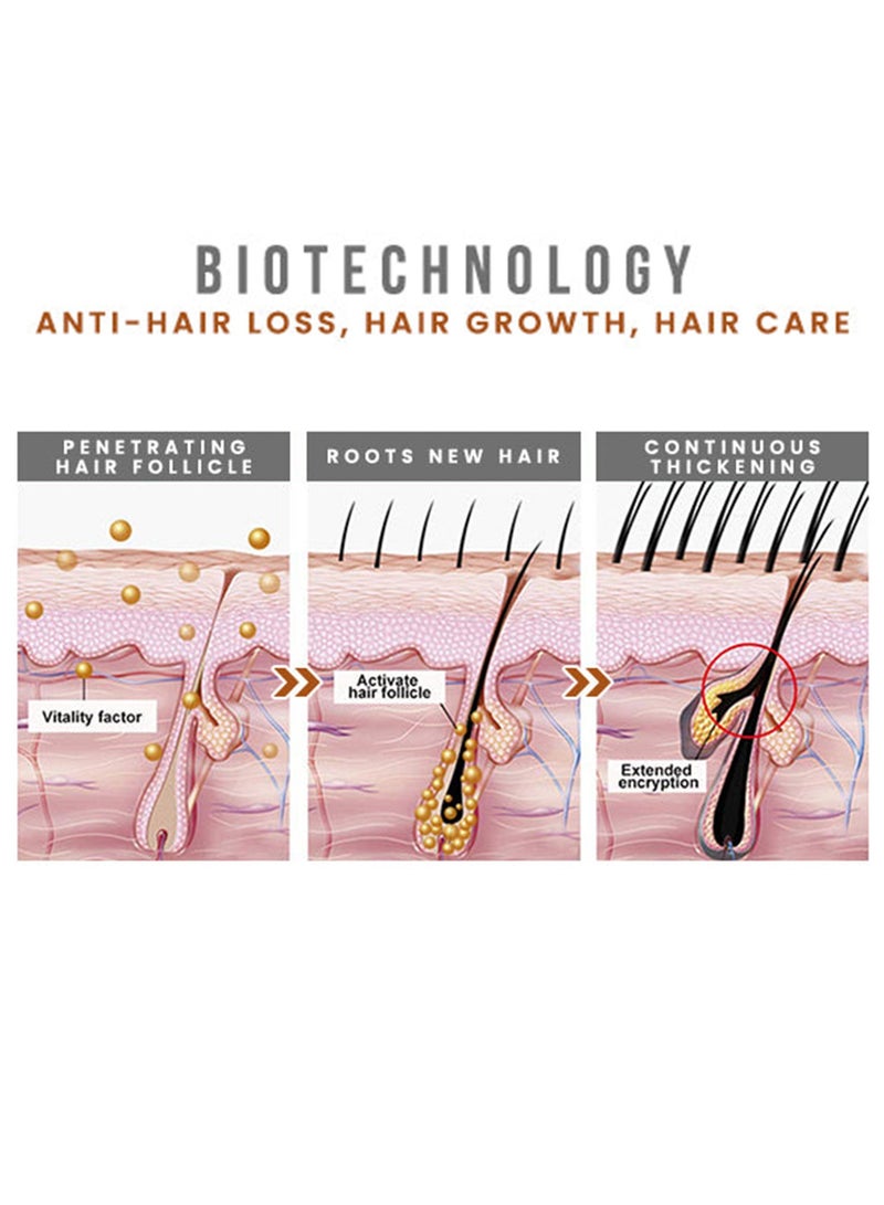 LUNOON's new scalp essential oil strengthens hair, repairs hair roots, damaged and thick hair essence 35ml - Image 4