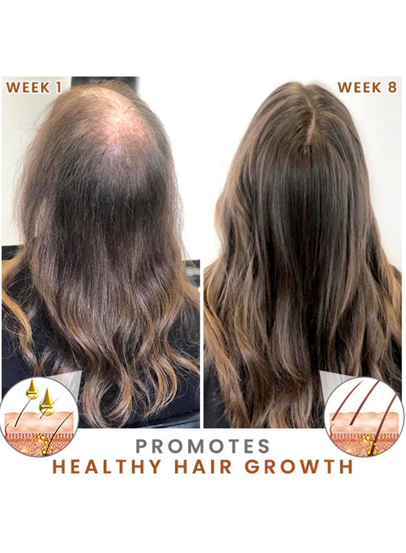 LUNOON's new scalp essential oil strengthens hair, repairs hair roots, damaged and thick hair essence 35ml - Image 2