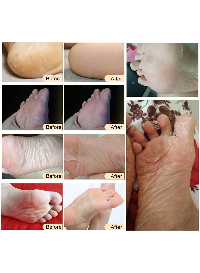 Pack of 3 Rose Exfoliating Foot Mask