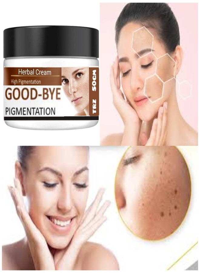 TRZ Bye Bye PigmentationCream | Anti PigmentationCream for Women/Men for Acne Scar Removal Pigmentation Dark Spots Anti Acne & HyperpigmentationCream - Image 4