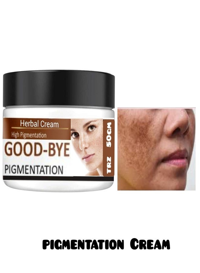 TRZ Bye Bye PigmentationCream | Anti PigmentationCream for Women/Men for Acne Scar Removal Pigmentation Dark Spots Anti Acne & HyperpigmentationCream - Image 3