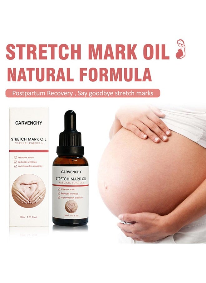 CARVENCHY Stretch Marks Remover Essential Oil - 100% Natural Pure Plant Extract 30ML- Stretch Marks Remover, Essential Oil Skin Care Treatment For Stretch Mark, Removal Maternity Slackline & Scar Removal  - Image 1