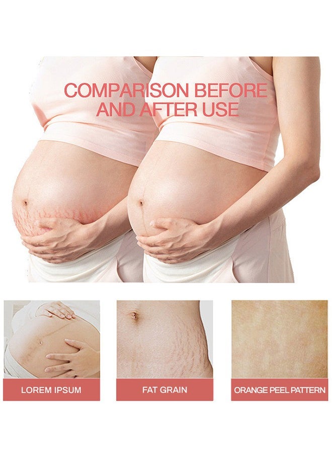 CARVENCHY Stretch Marks Remover Essential Oil - 100% Natural Pure Plant Extract 30ML- Stretch Marks Remover, Essential Oil Skin Care Treatment For Stretch Mark, Removal Maternity Slackline & Scar Removal  - Image 3