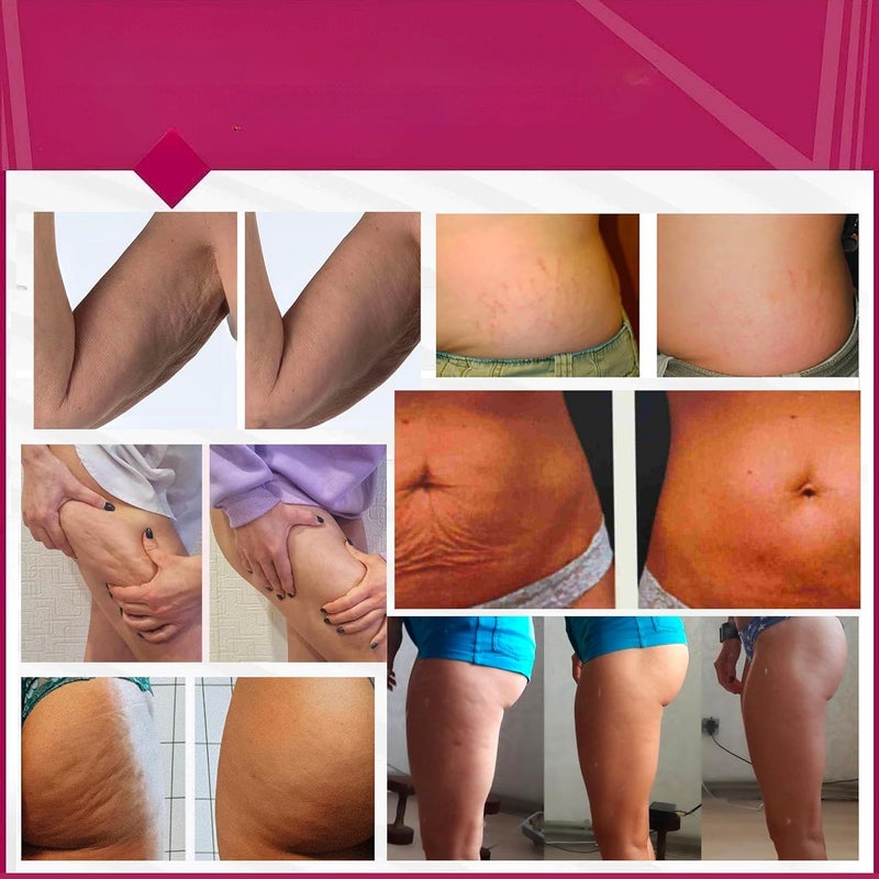 Anacis Anti-Cellulite Advanced Hot Body Cream Gel For Even Skin and Elasticity. Anacis - 5.07 Oz - Image 5