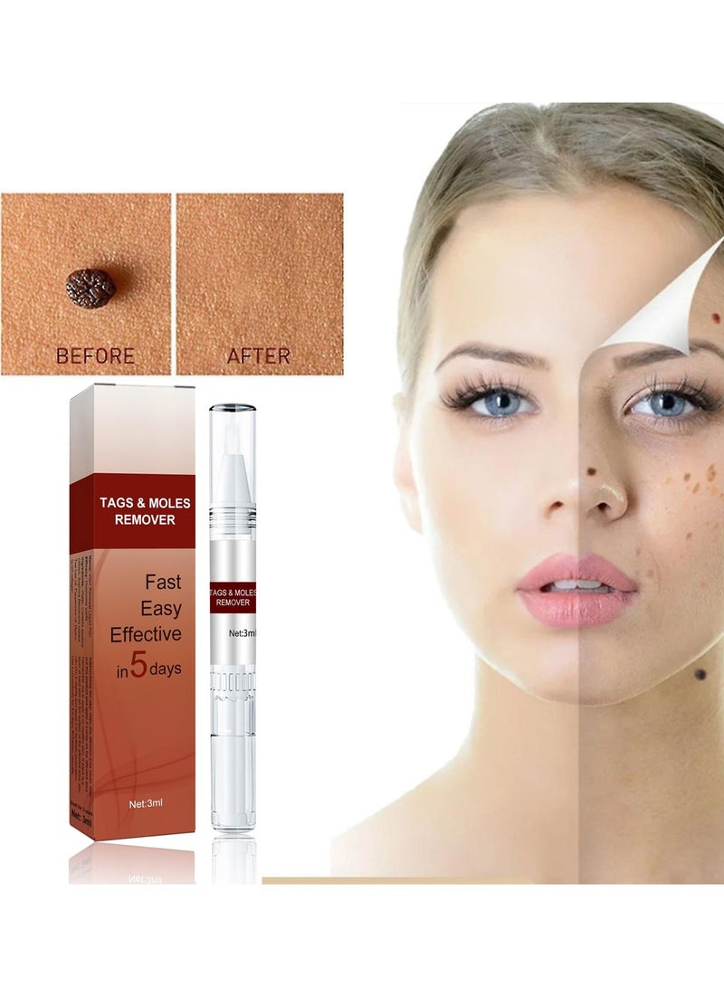 DubaiGallery Wipeoff Skin Tags & Moles Warts Corn Remover, Tags & Moles Remover,Wipeoff Tags & Moles Remover,Wipe Off Skin Tags and Mole Remover,Restore Skin Health and Beauty - Image 2